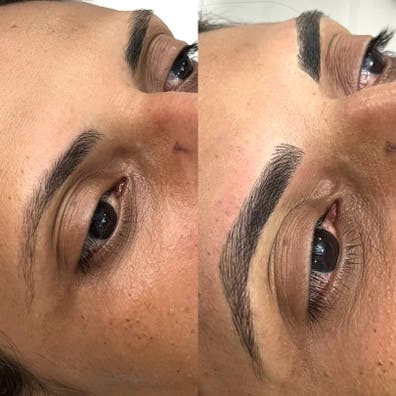 70€ Micropigmentacíon
