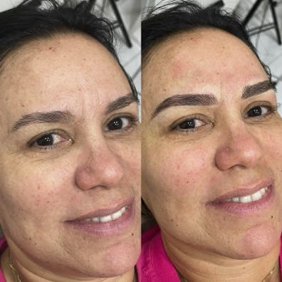 70€ Micropigmentacíon