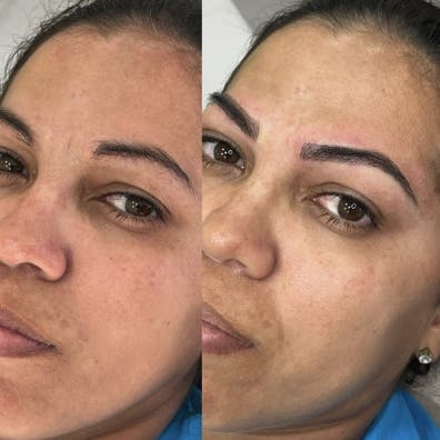 70€ Micropigmentacíon