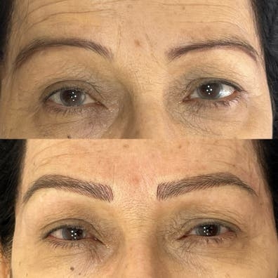 70€ Micropigmentacíon