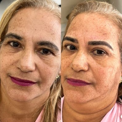 70€ Micropigmentacíon