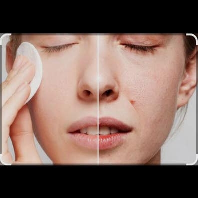 Limpieza facial