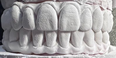 Protésico Dental