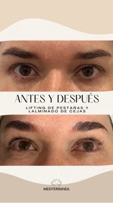 LIFTING DE PESTAÑAS Y LAMINADO DE CEJAS
