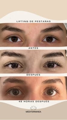 LIFTING DE PESTAÑAS Y LAMINADO DE CEJAS